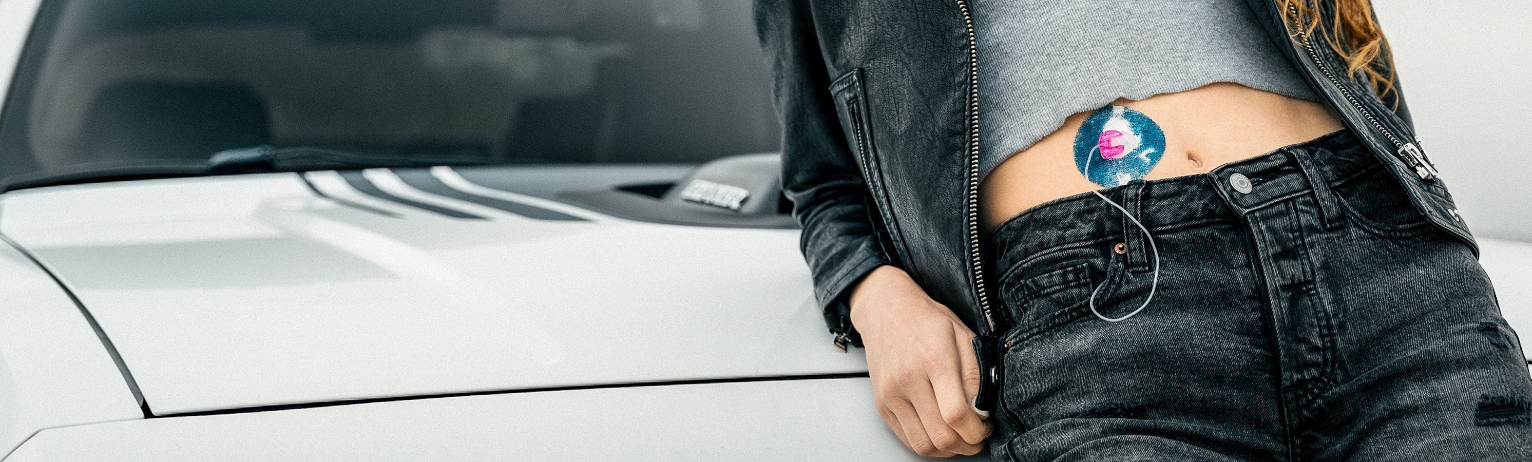 A person in jeans and a leather jacket leaning against a white car, with a blue floral CGM adhesive patch visible on their abdomen connected to infusion set tubing