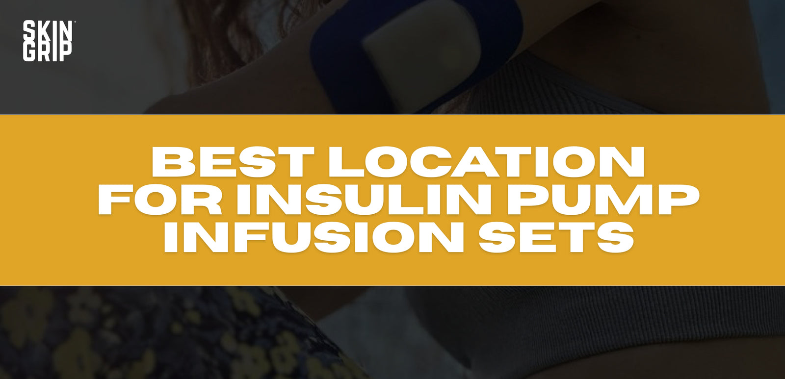 Best location for insulin pump infusion sets