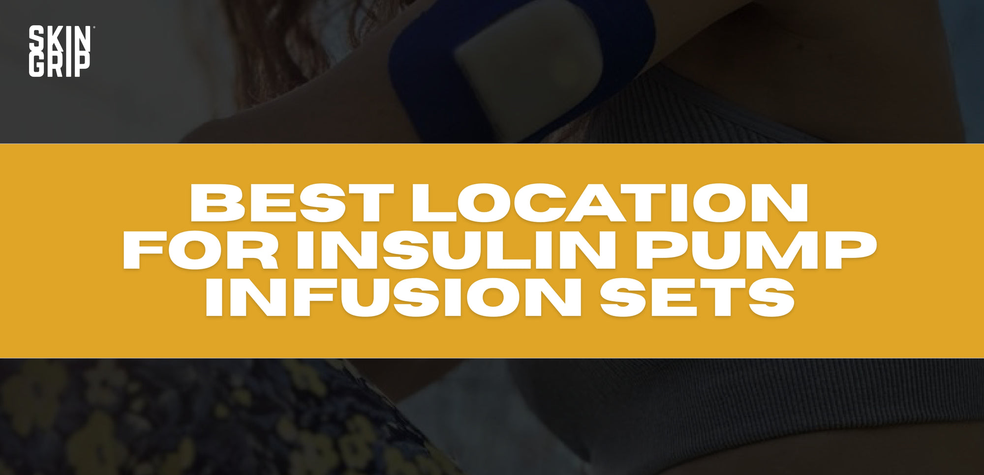 Best location for insulin pump infusion sets