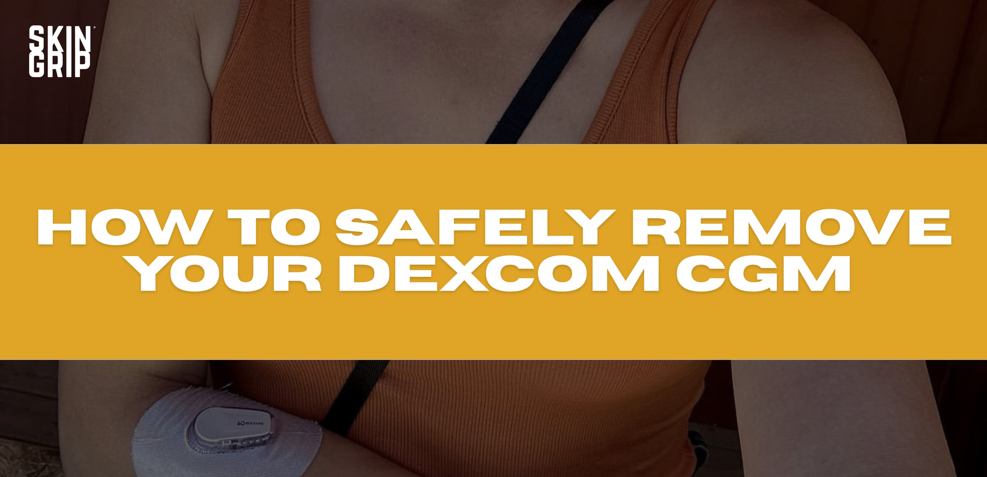 How to Safely Remove the Dexcom G6 Continuous Glucose Monitor