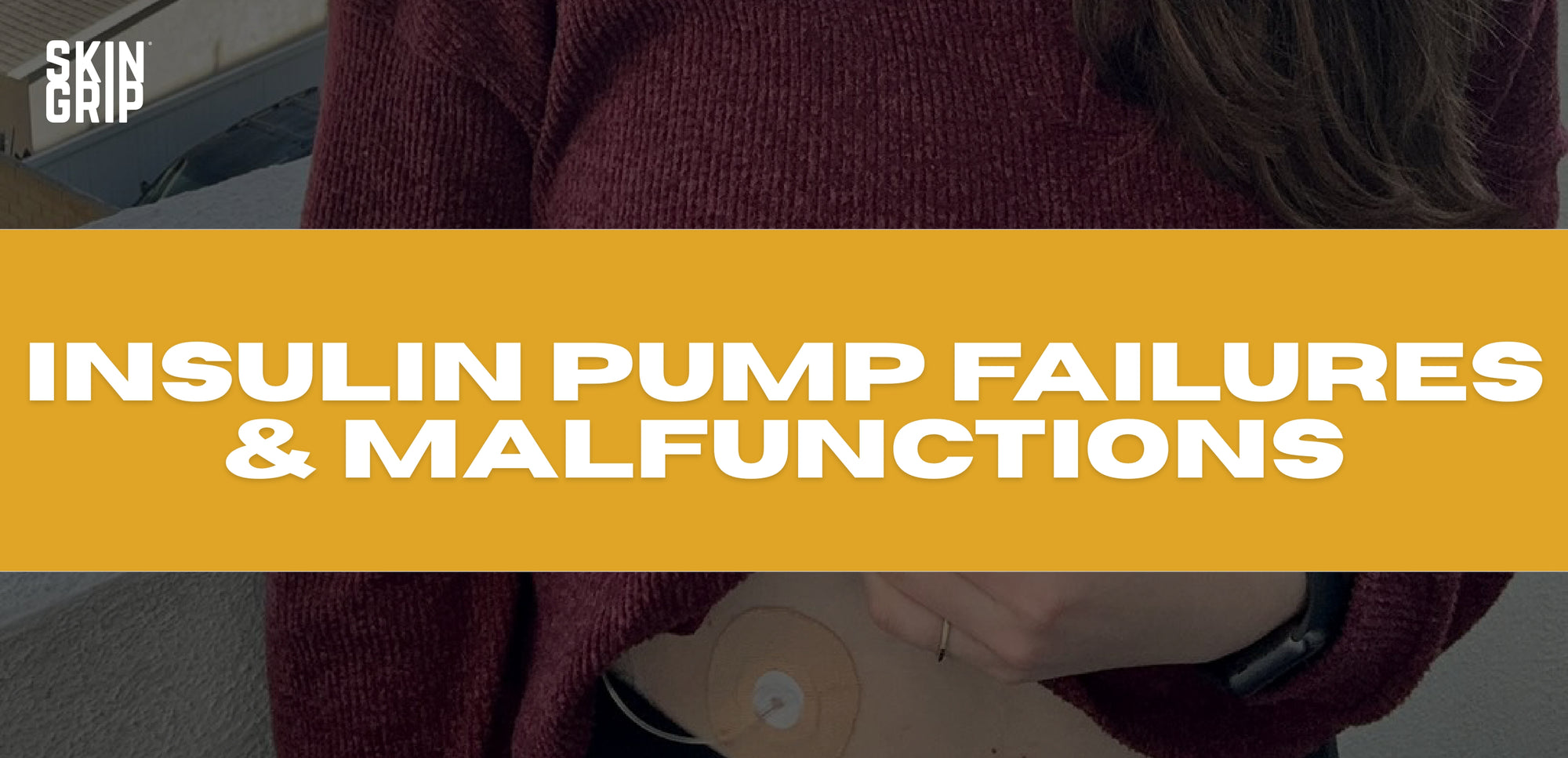 Insulin Pump Failures & Malfunctions: What is an insulin pump backup plan and when should it be used?
