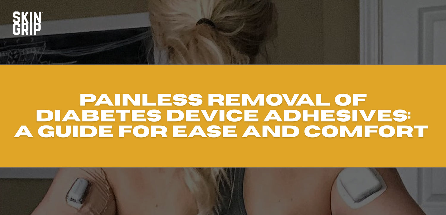 Painless Removal of Diabetes Device Adhesives: A Guide for Ease and Comfort