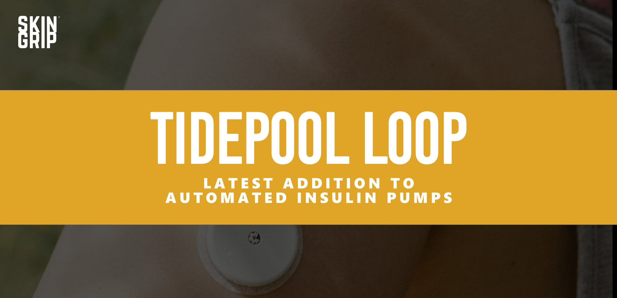 Tidepool Loop: Latest Addition to Automated Insulin Pumps