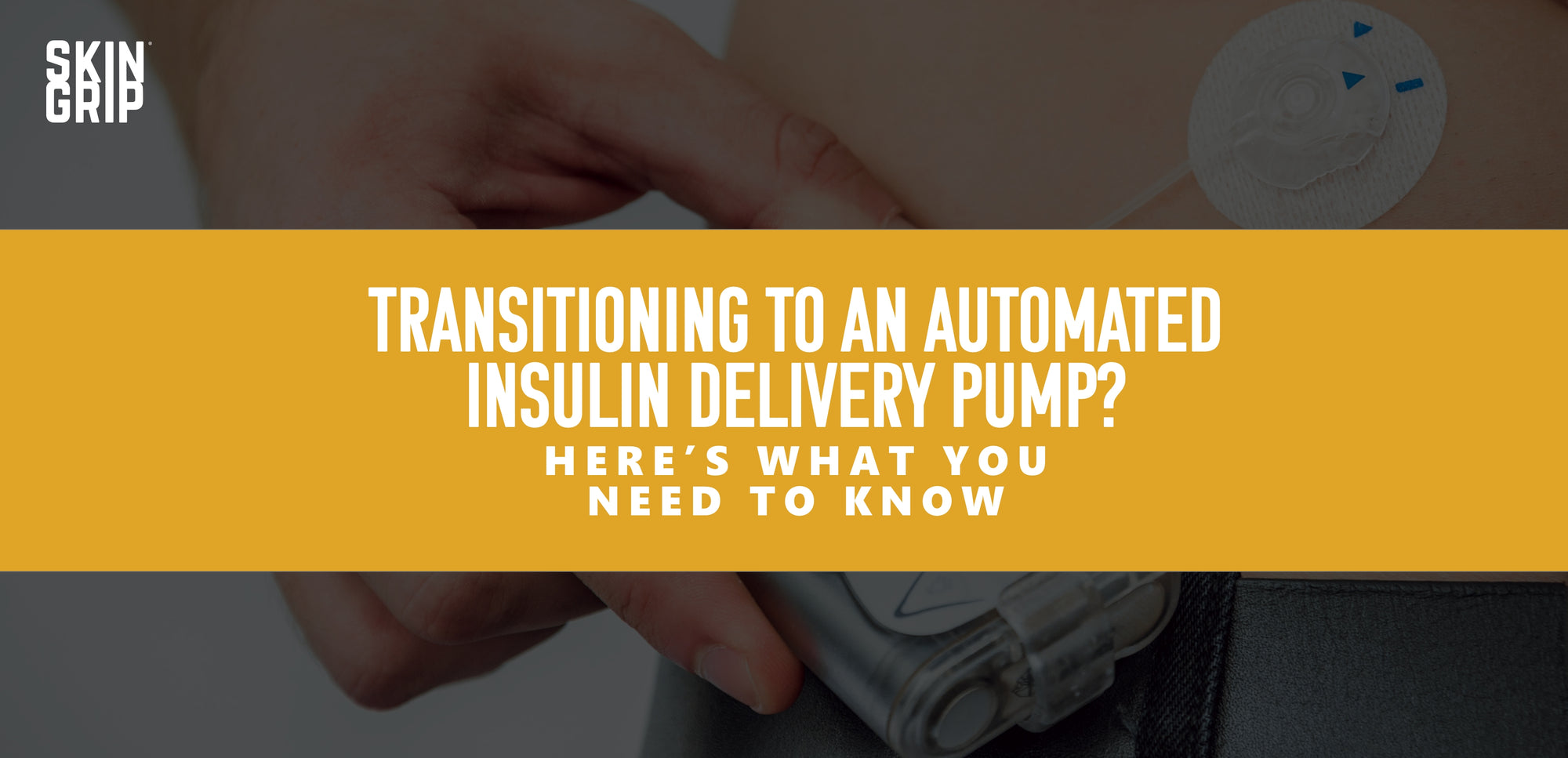 Transitioning to an Automated Insulin Delivery Pump?: Here’s What You Need to Know