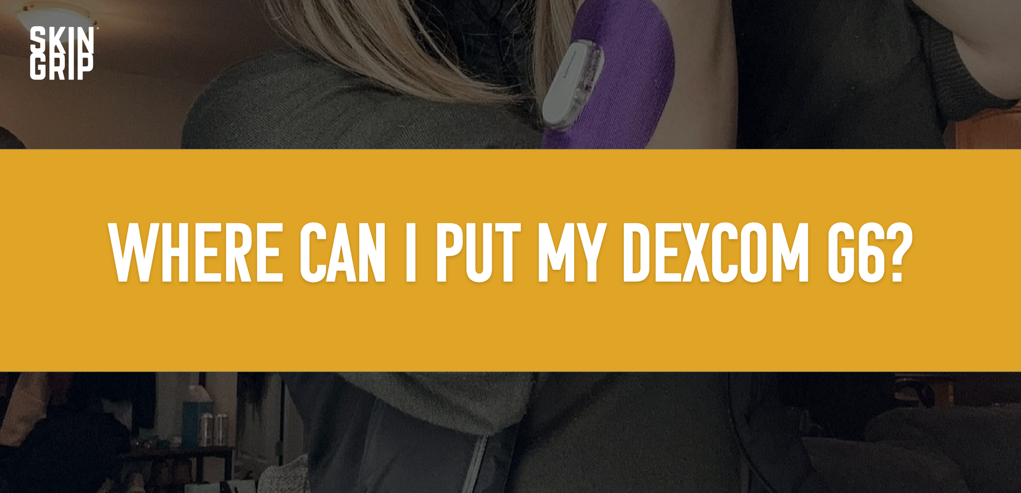 Dexcom G6 Placement: Best Spots on Your Body to Wear It