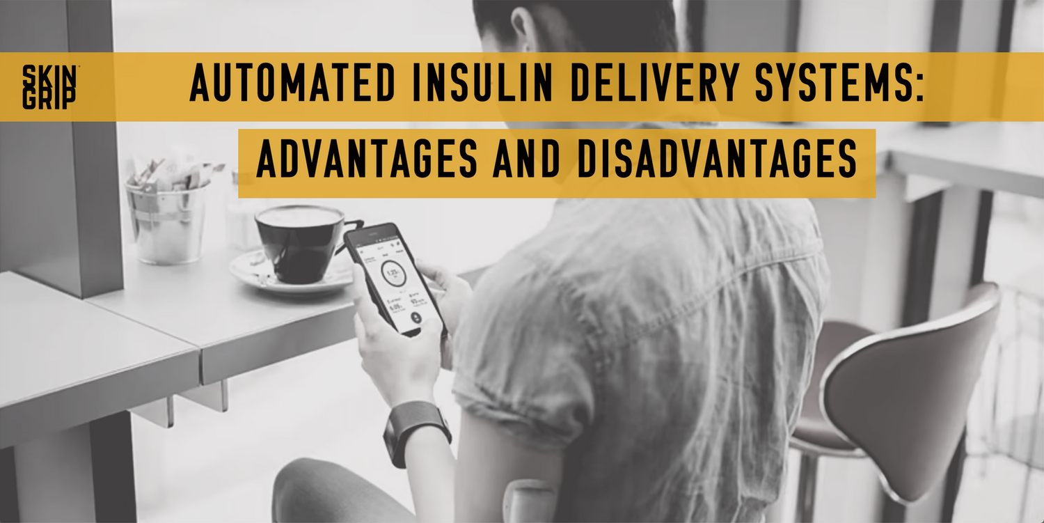 Automated Insulin Delivery Systems: Advantages and Limitations 