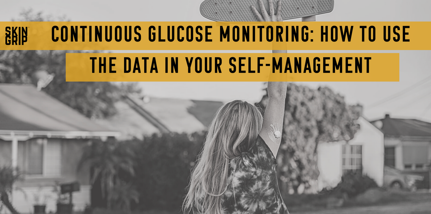 Continuous Glucose Monitoring