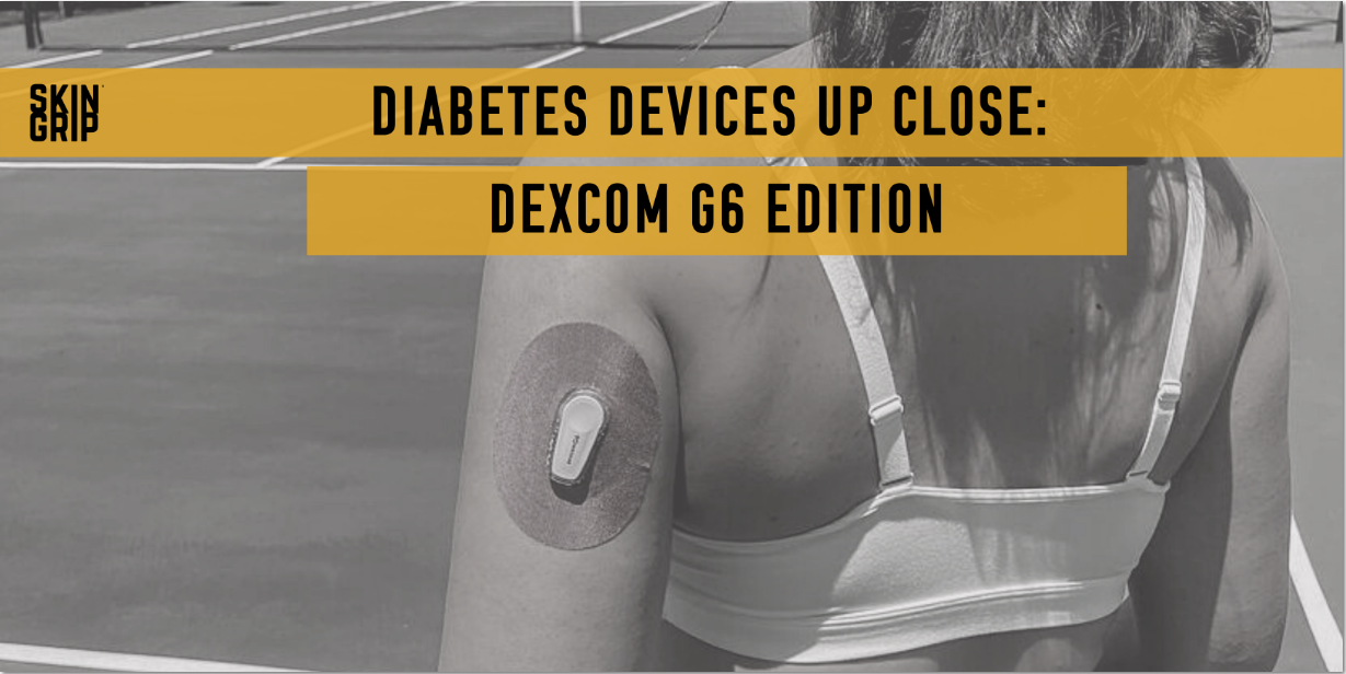 Diabetes Devices Up Close: Dexcom G6 Edition 