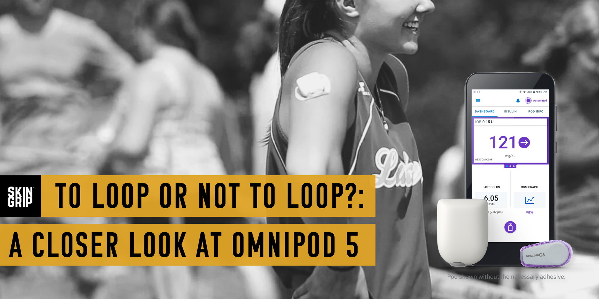 To Loop or Not to Loop?: A Closer Look at Omnipod 5