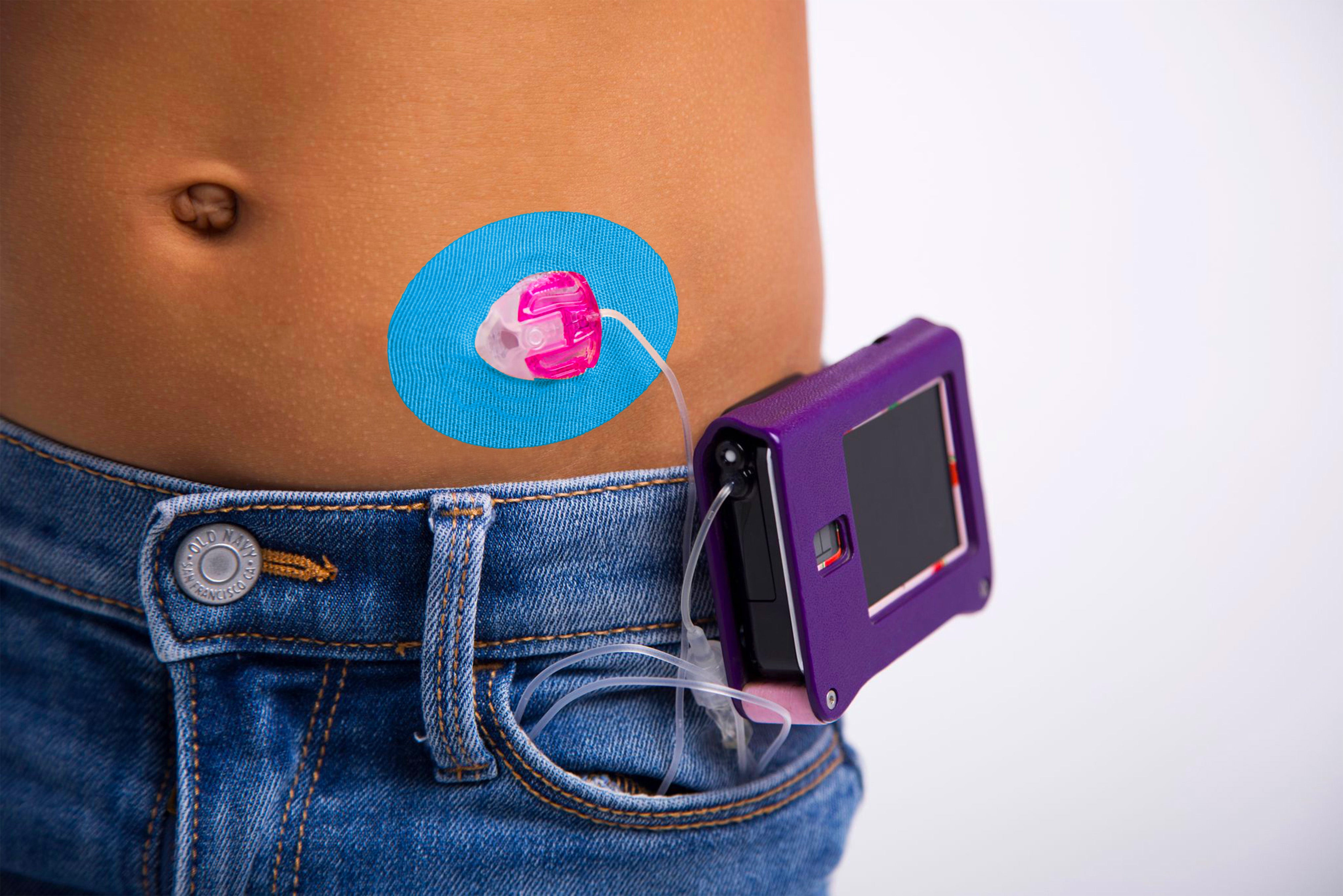 Skin Grip Original - Universal Adhesive Patches (0.8 inch Hole)