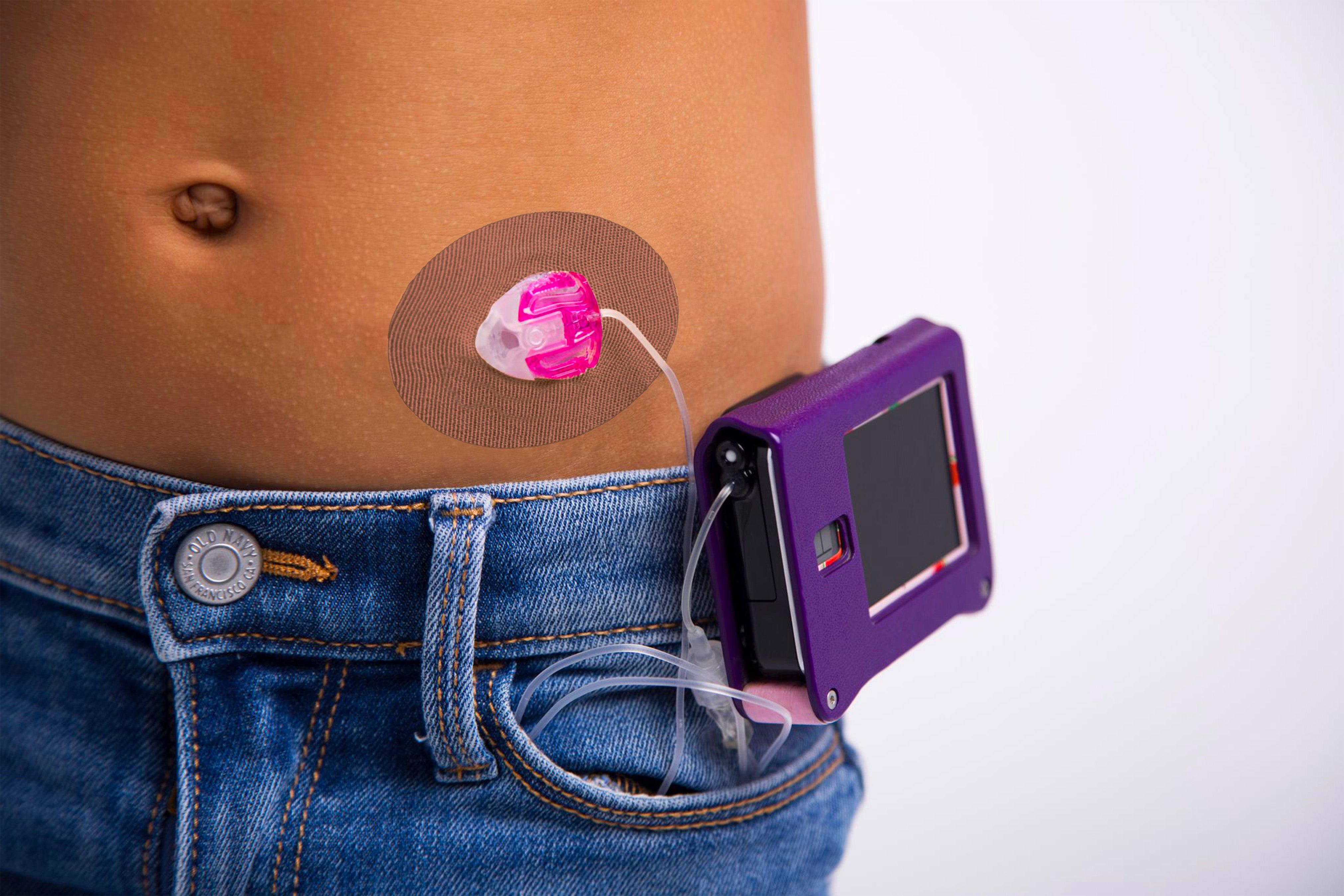 Skin Grip Original - Universal Adhesive Patches (0.8 inch Hole)