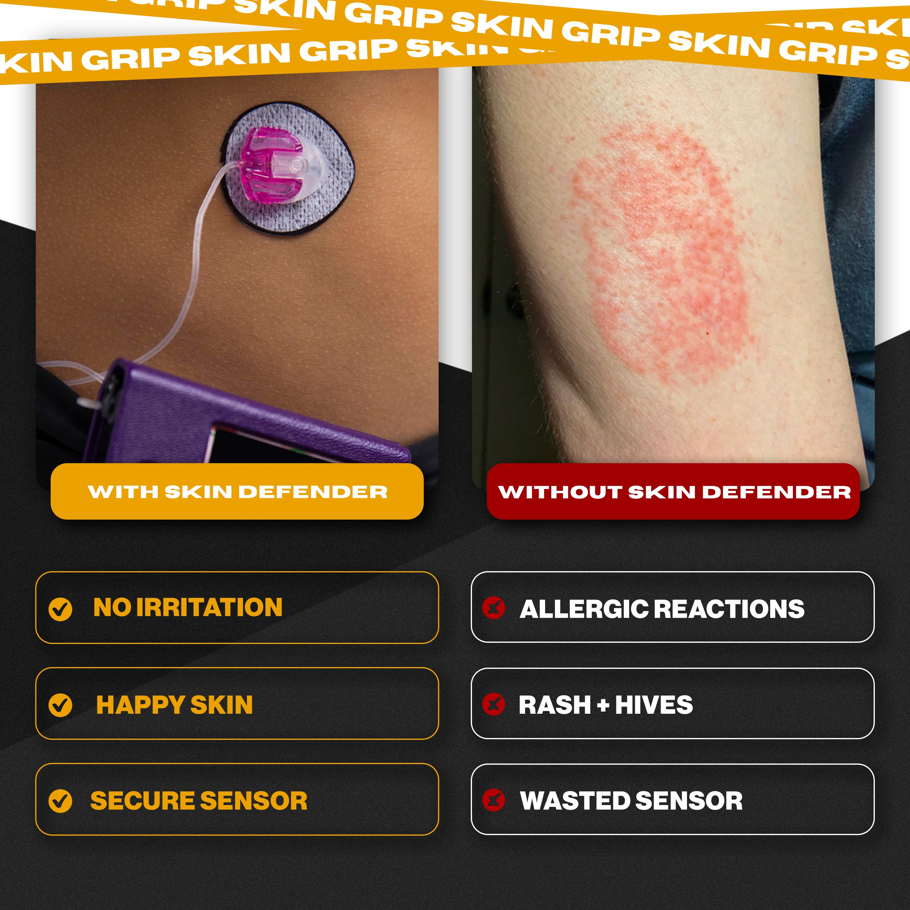 Skin Defender Reusable Non-Adhesive Barrier - 5 Pack