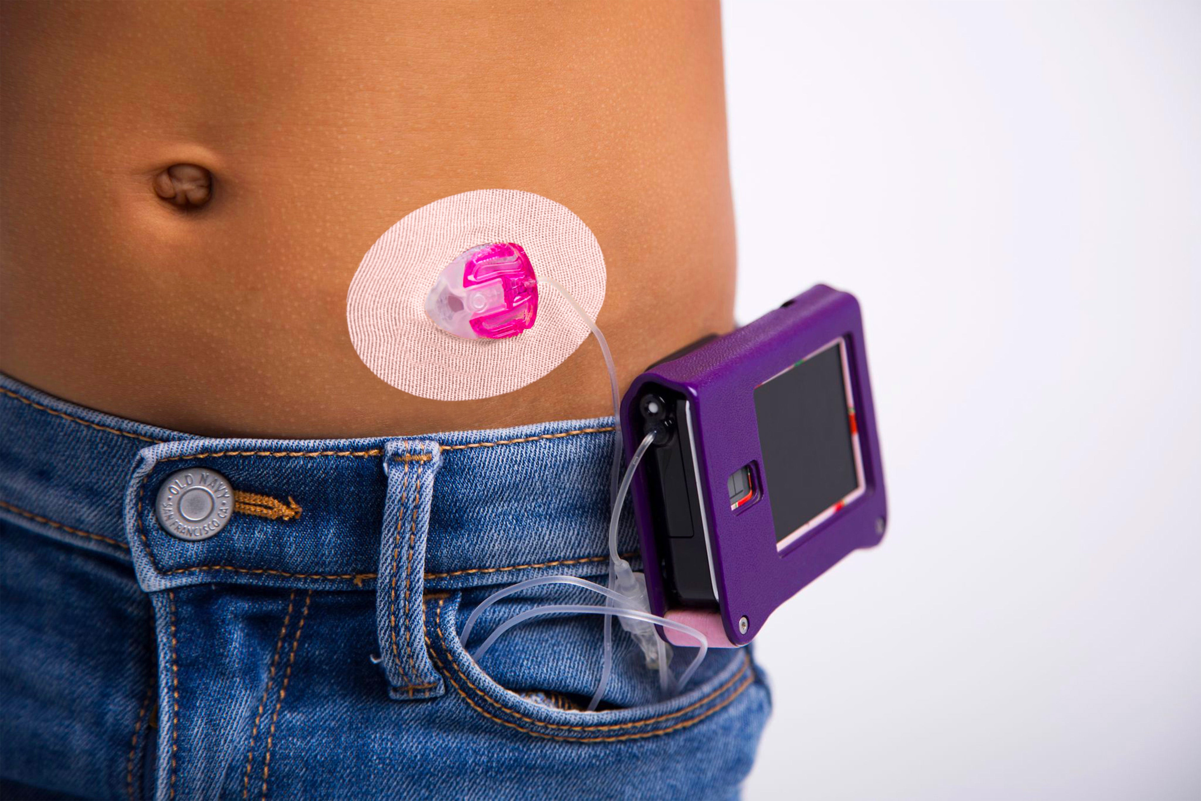 Skin Grip Original - Universal Adhesive Patches (0.8 inch Hole)