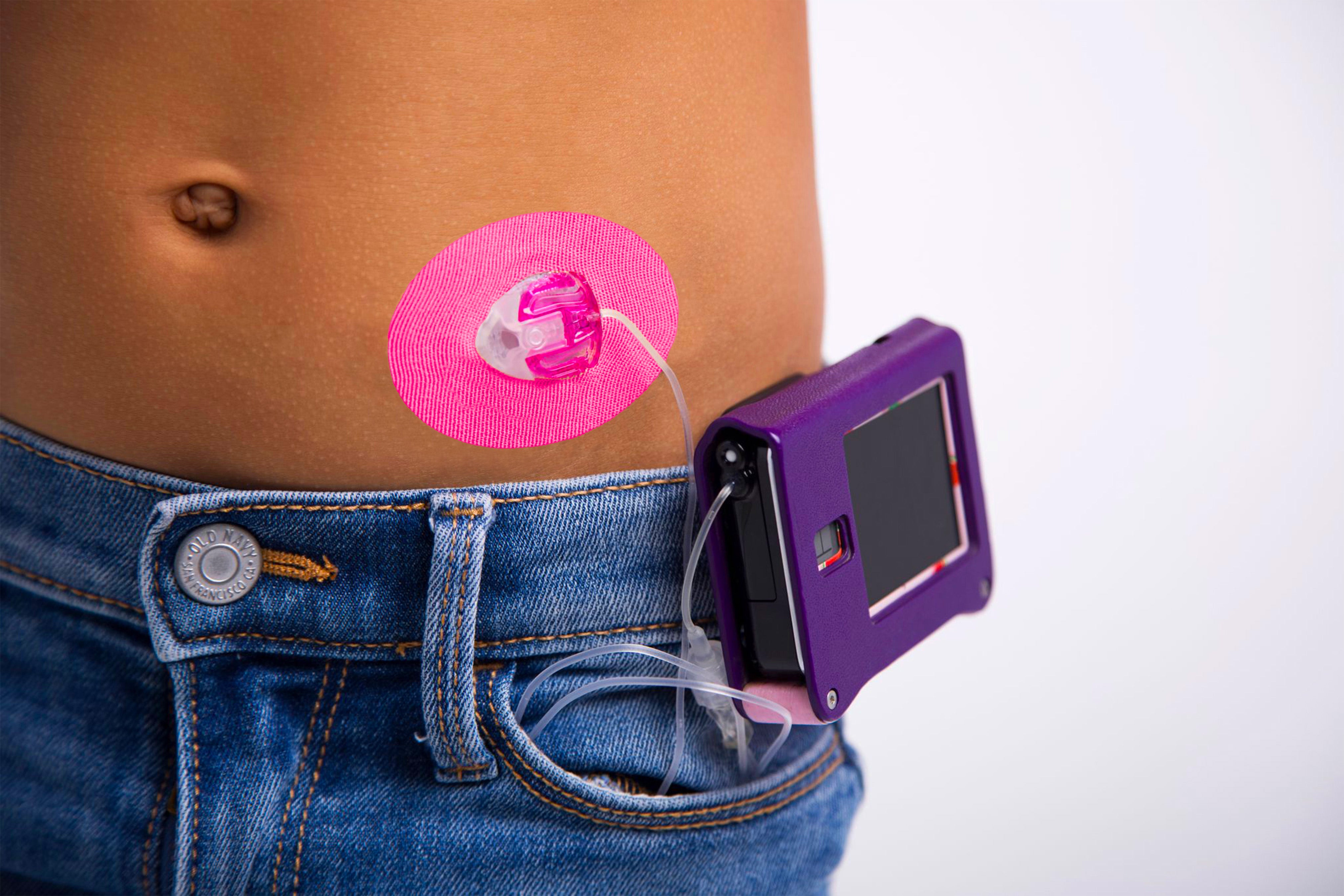 Skin Grip Original - Universal Adhesive Patches (0.8 inch Hole)