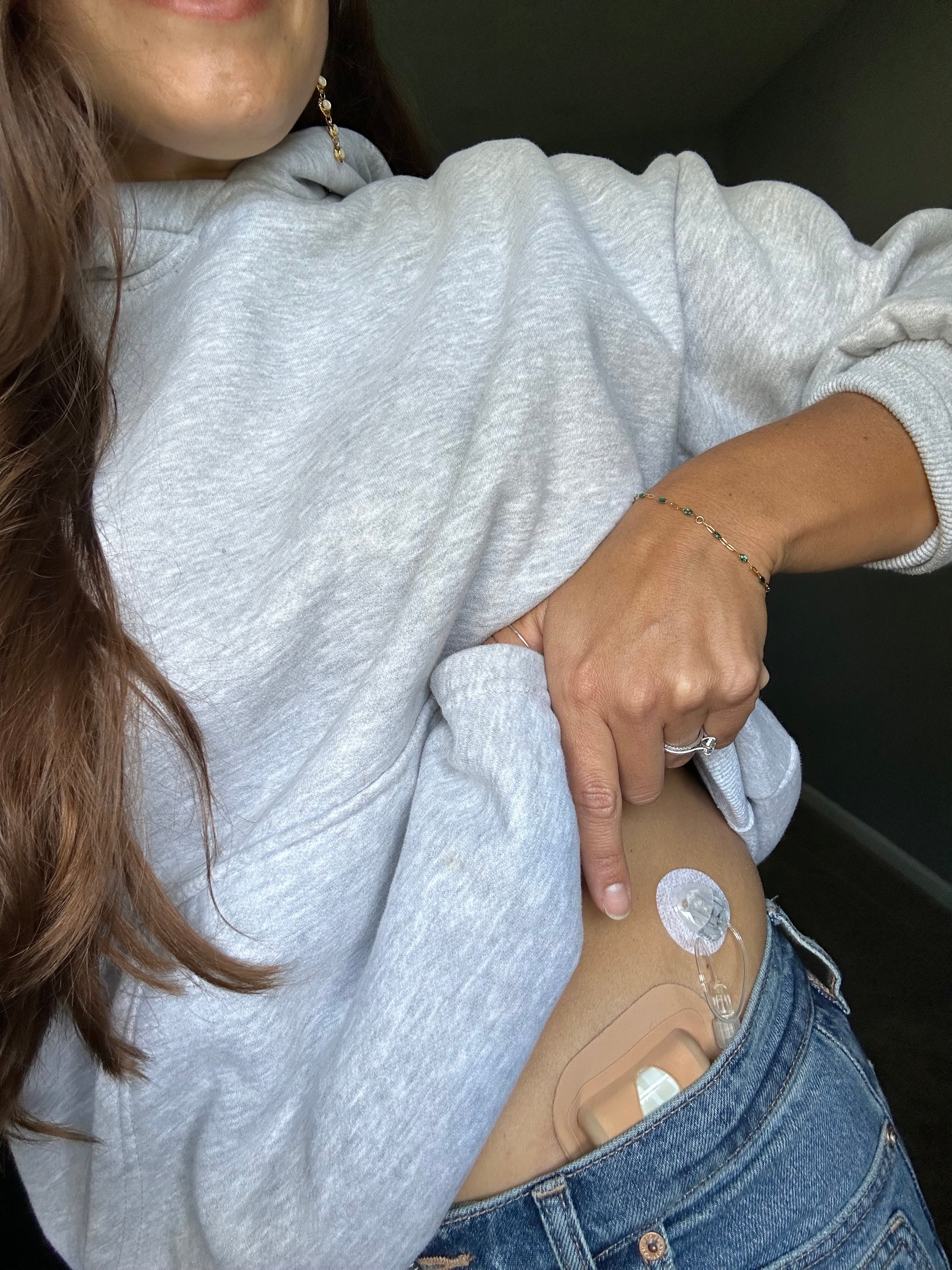 Skin Grip - Tandem Mobi Pocket Patch