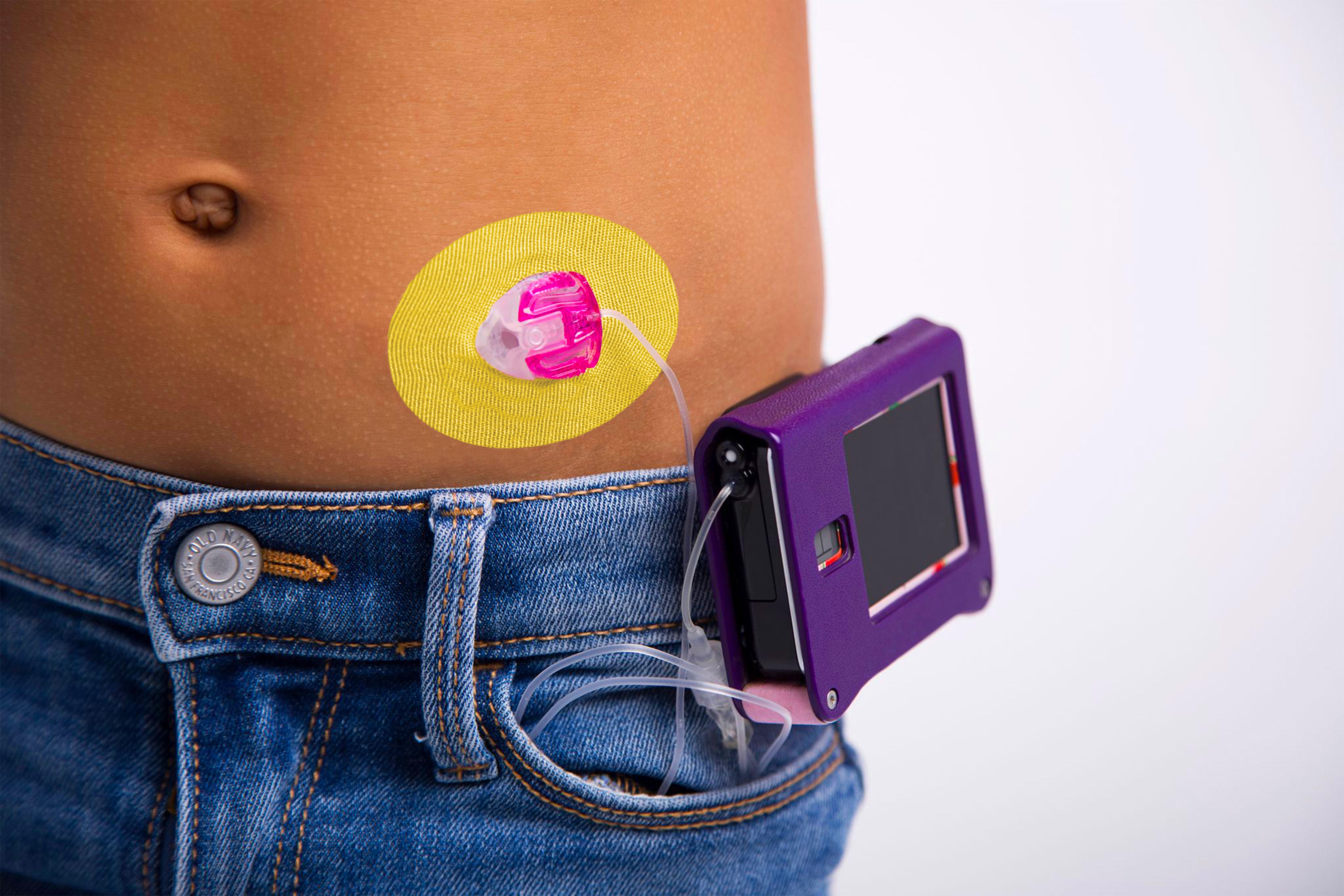 Skin Grip Original - Universal Adhesive Patches (0.8 inch Hole)