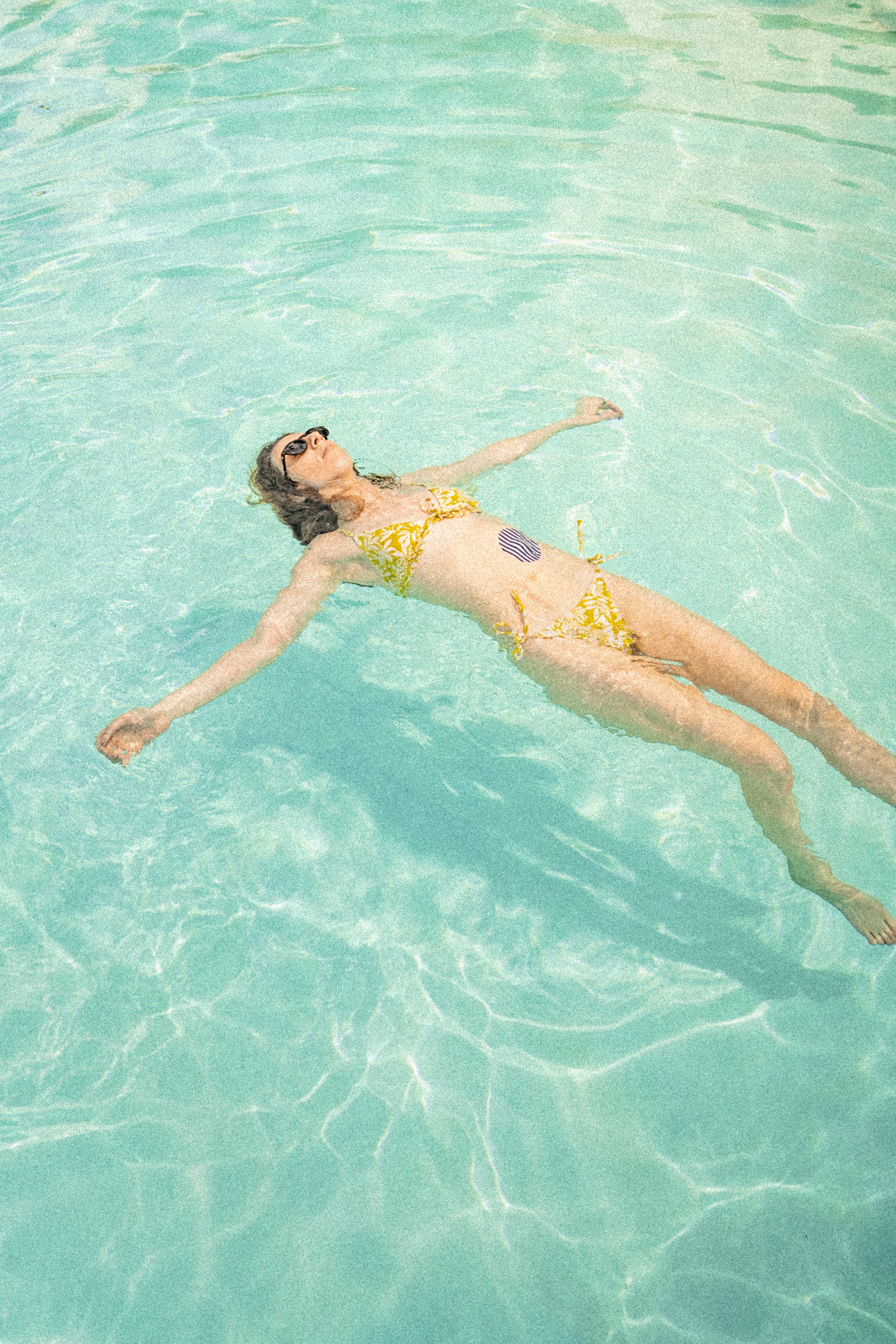 Skin Grip Original - Medtronic Guardian/Enlite Adhesive Patches