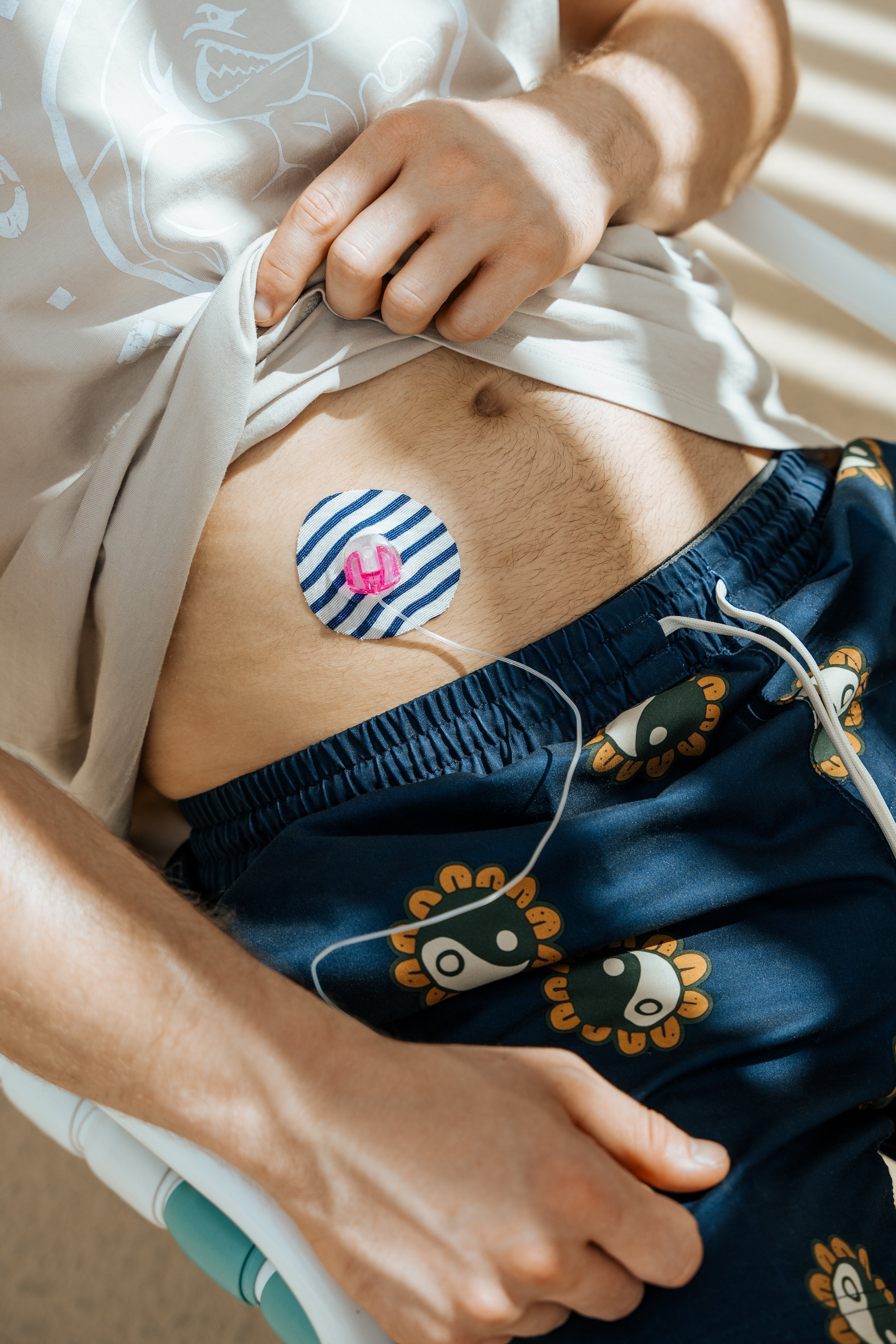 Skin Grip Original - Universal Adhesive Patches (0.8 inch Hole)