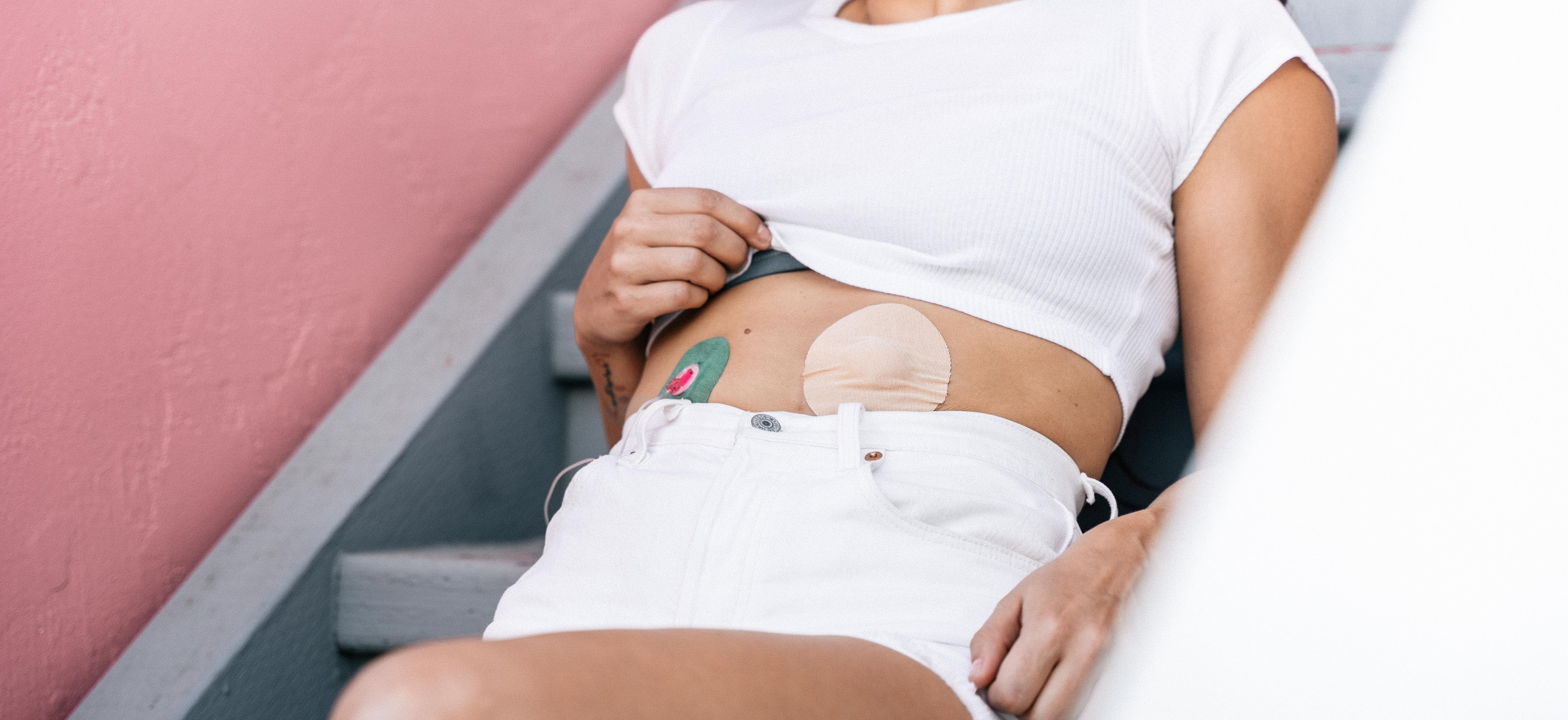 Skin Grip Original - Medtronic Guardian/Enlite Adhesive Patches