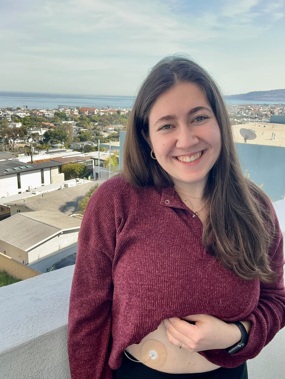 Skin Grip Original - Universal Adhesive Patches (0.8 inch Hole)